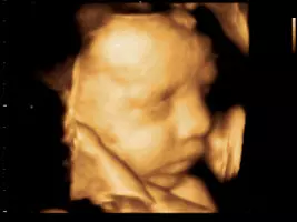 3Di4DultrazvukuKarlovcu2