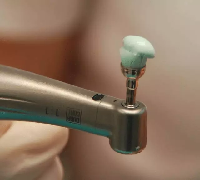 Bijeleplombe,ljuskice,proteze,izbjeljivanje,manjikirurškizahvatiVaraždinskažupanija4 Bijeleplombe,ljuskice,proteze,izbjeljivanje,manjikirurškizahvatiVaraždinskažupanija4