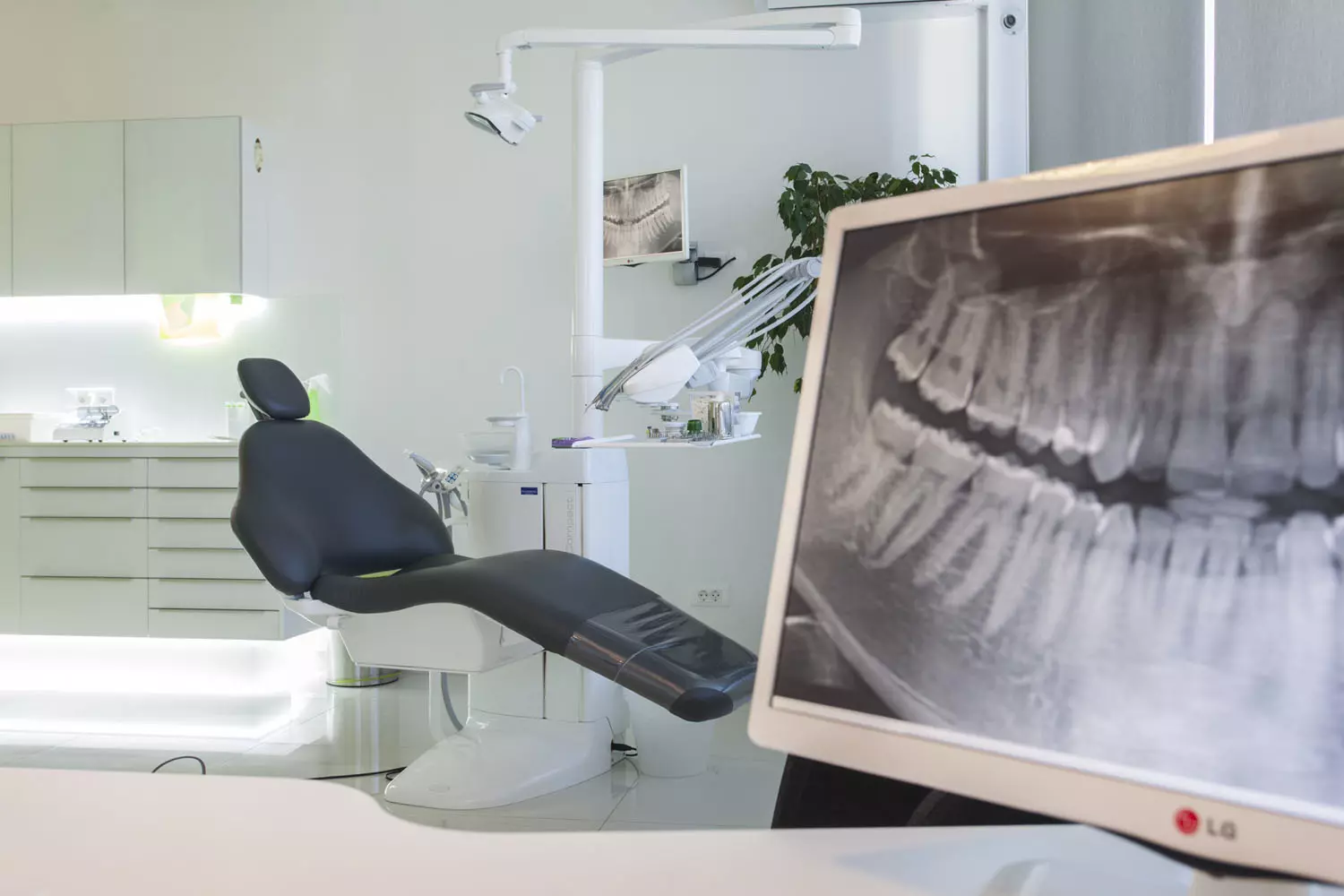 Endodoncija i konzervativna stomatologija Usluge endodoncije te konzervativne stomatologije, Zagreb, Hrvatska