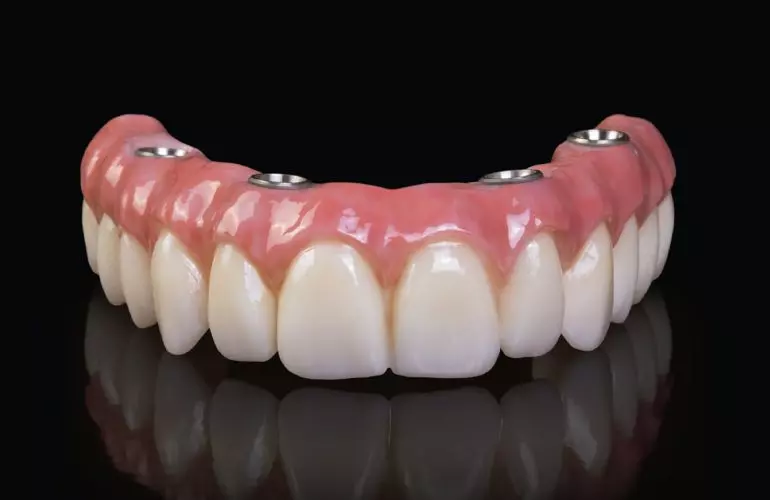 Fiksna i mobilna protetika uz implantologiju Bjelovar, Hrvatska