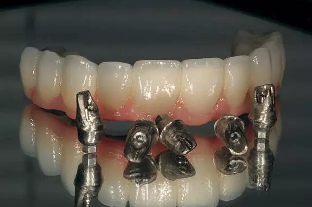 DentalnilaboratorijLabin1