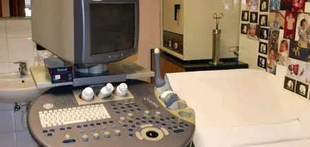 Trodimenzionalni ultrazvuk 3D i 4D, grad Zagreb Hrvatska