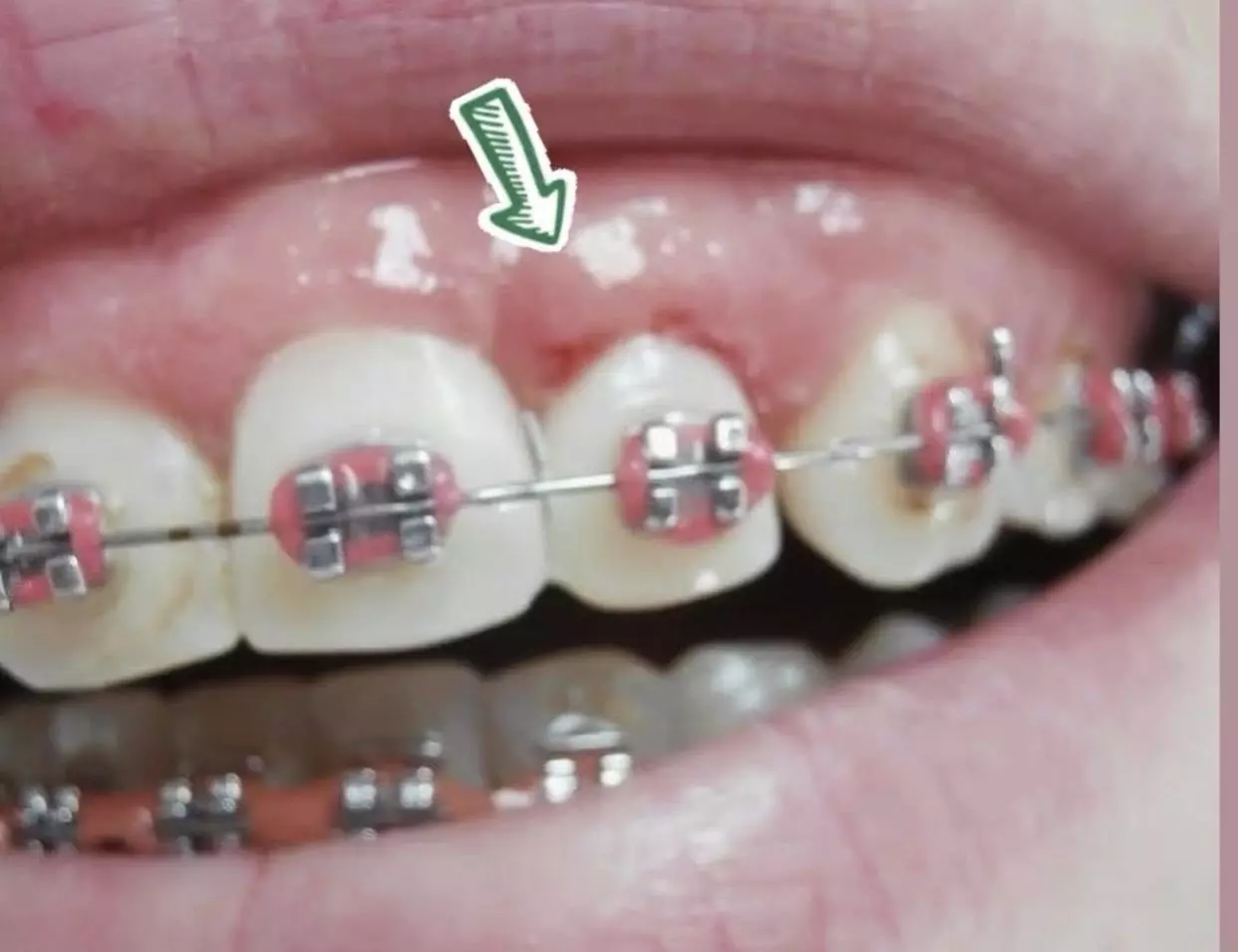 Estetska stomatologija Banja Luka