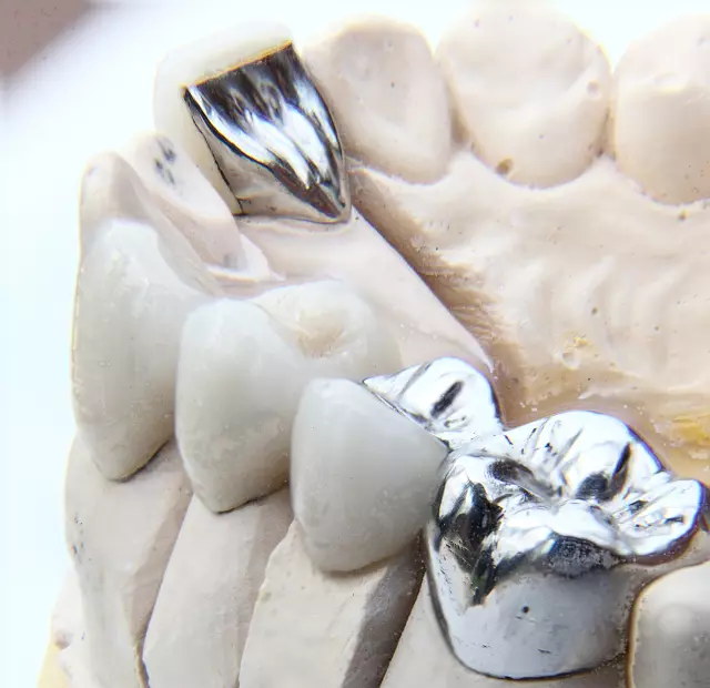 Fiksna_i_mobilna_protetika_Rijeka1 Fiksna_i_mobilna_protetika_Rijeka1