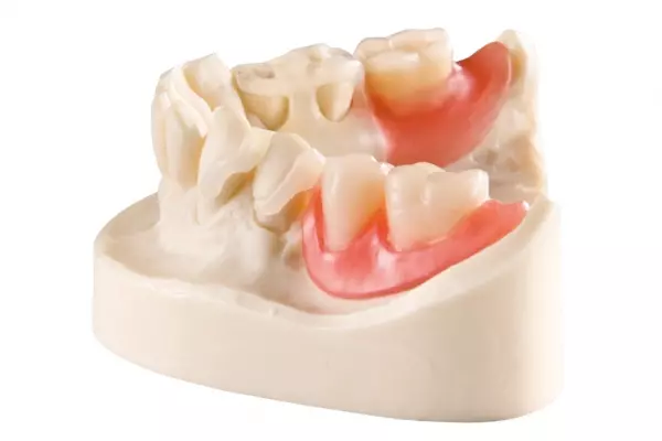 Fiksnaimobilnaprotetika,Zagreb Fiksnaimobilnaprotetika,Zagreb