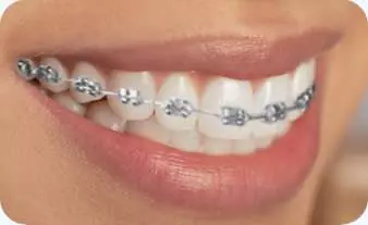 FiksnaimobilnaprotetikaRijeka3