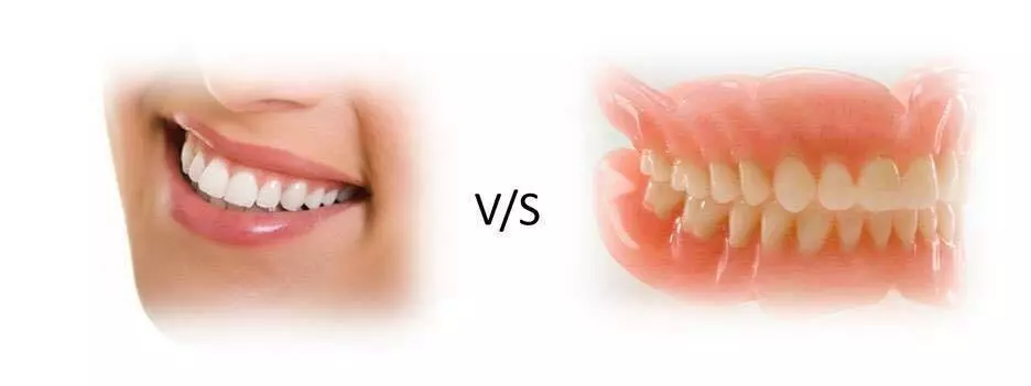 Izbjeljivanje zubi Izbjeljivanje zubi, Pantovčak