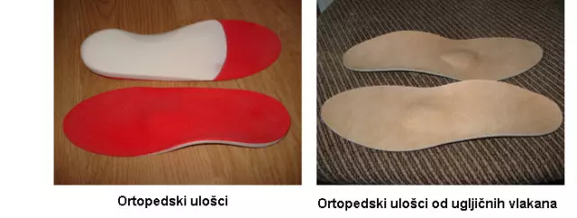 Izradaprotezasdrvenimležištemzanatkoljeneproteze,Oroslavlje2 Izradaprotezasdrvenimležištemzanatkoljeneproteze,Oroslavlje2