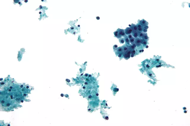 Kliničkacitologija,citodijagnostika,Karlovac2