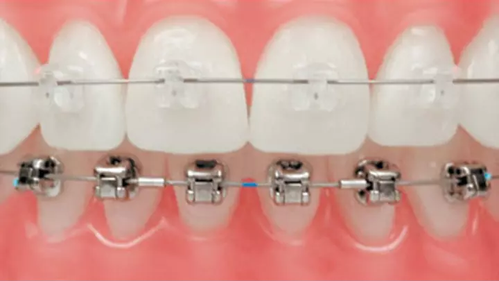 usluga stomatologa Kompletne stomatološke usluge, Zambratija