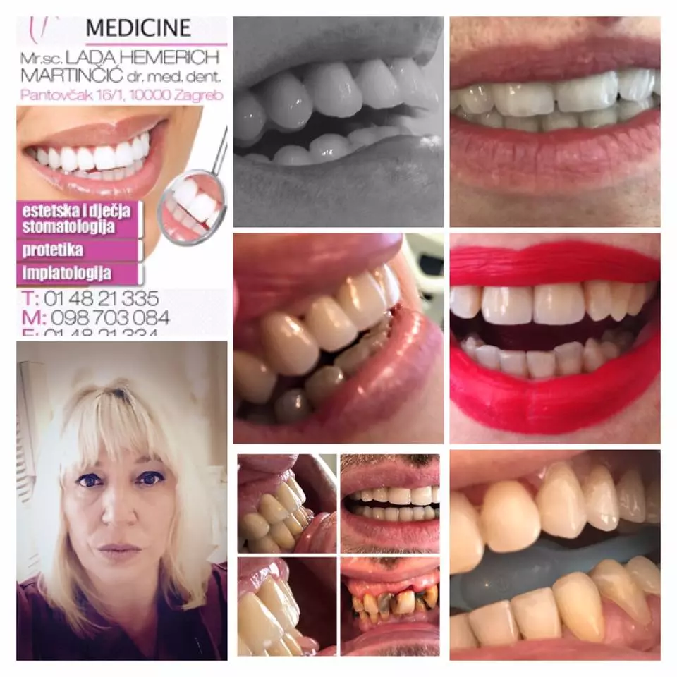  stomatološke usluge