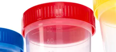 Laboratorijskipotrošnimaterijal,Zagreb,Zagrebačkažupanija,Hrvatska