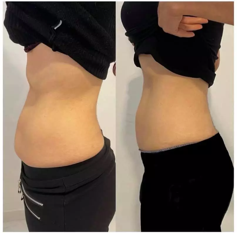 Manuela Shala masaža Zagreb, RH