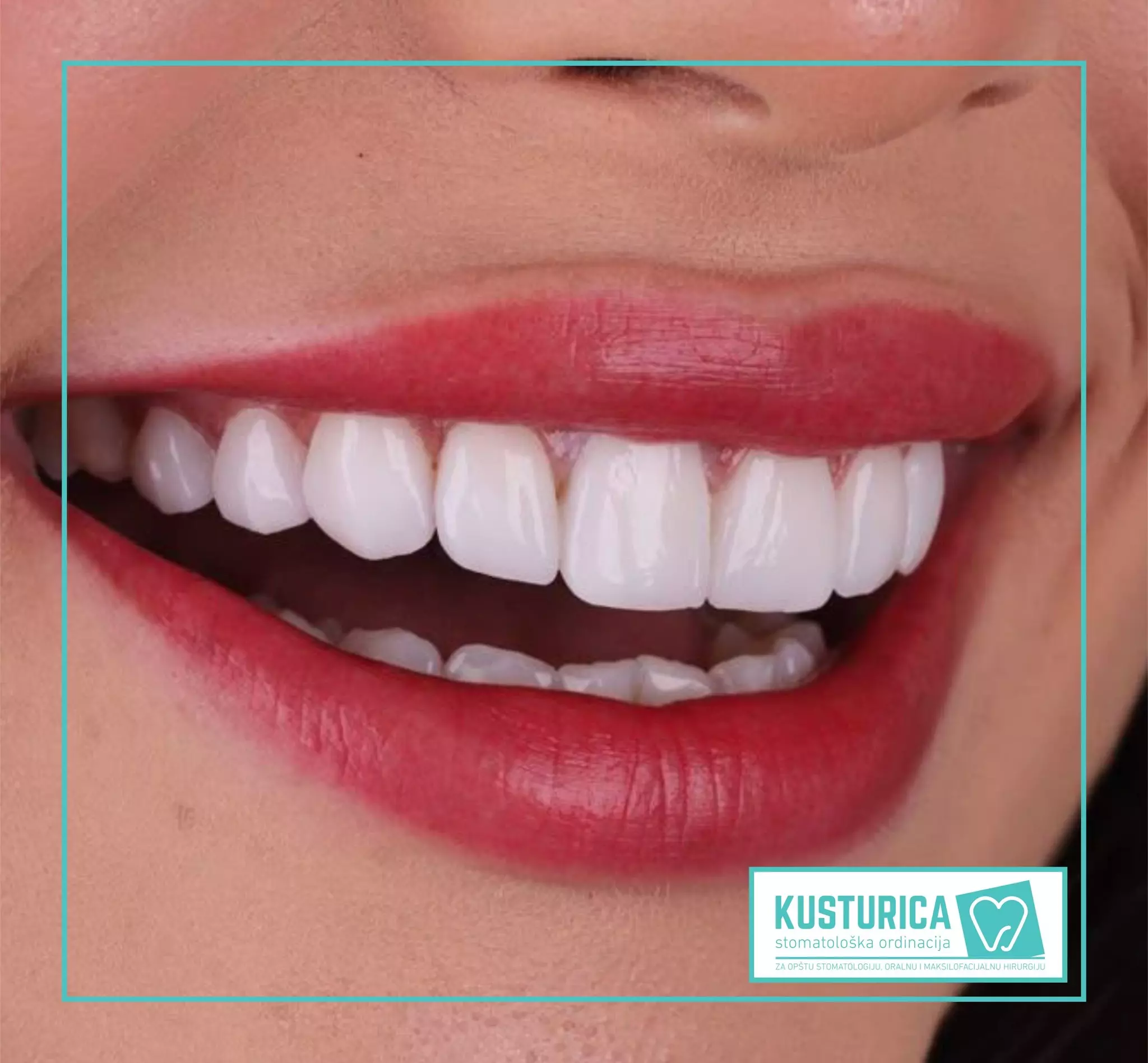 Maksilofacijalna hirurgija u Brčkom, BiH