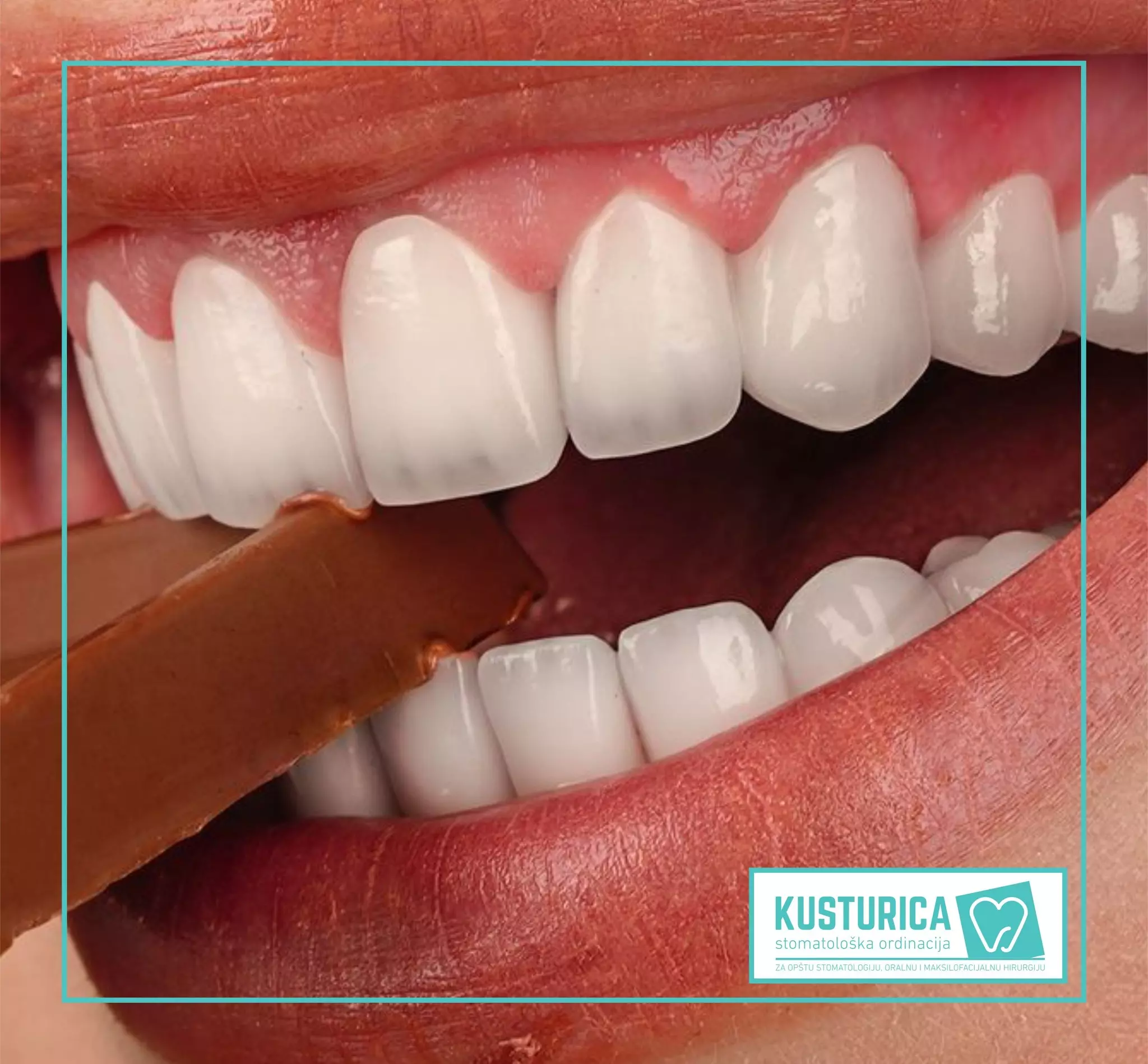 Bezbolna ugradnja implantata u Brčkom, BiH