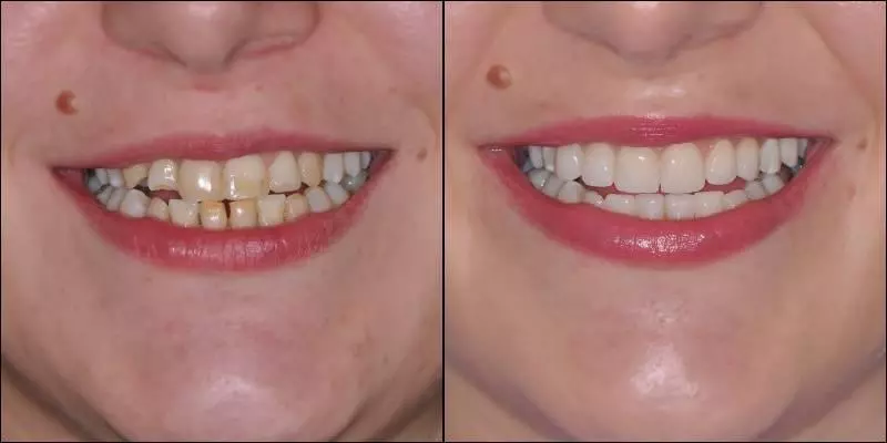 stomatolog Parodontologija Trešnjevka, Zagreb