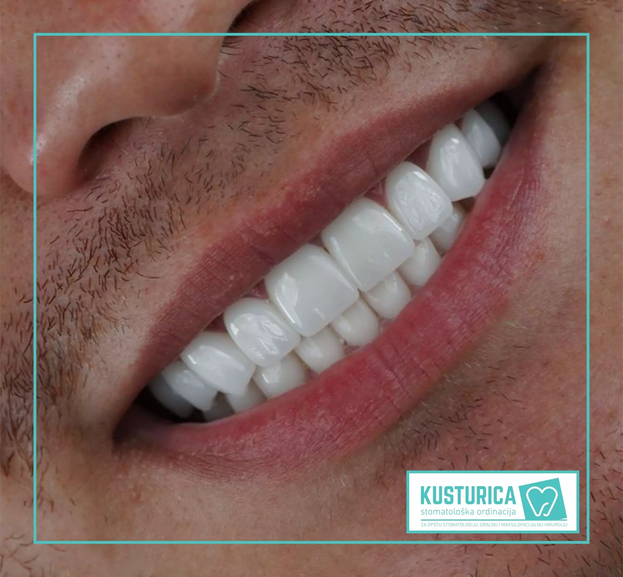 Polivalentna ordinacija u Brčkom, BiH