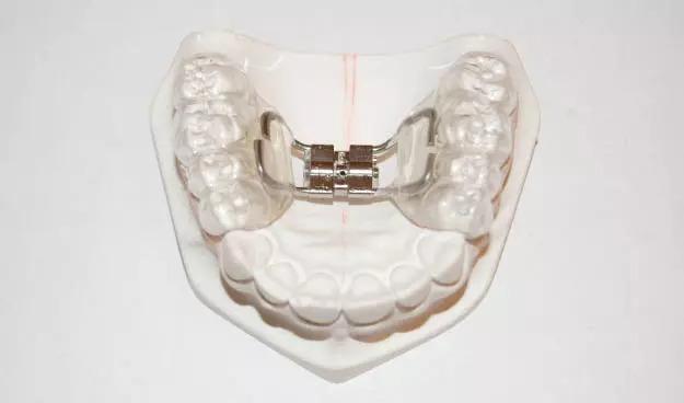 PrivatnastomatologijaiortodoncijaZagreb2 PrivatnastomatologijaiortodoncijaZagreb2