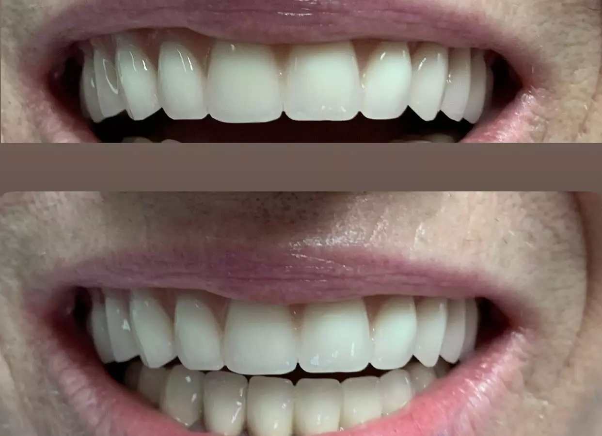 Protetika Banja Luka