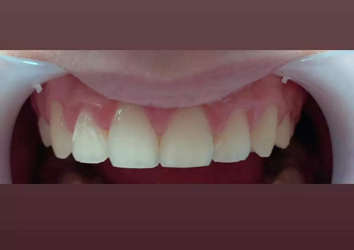 Protetika Banja Luka, BiH