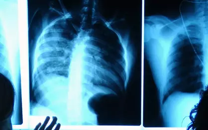 Ultrazvuk dojki, grad Osijek, Hrvatska