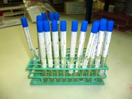 RejuvenacijaintimneregijeradiofrekvencijomRijeka1 RejuvenacijaintimneregijeradiofrekvencijomRijeka1