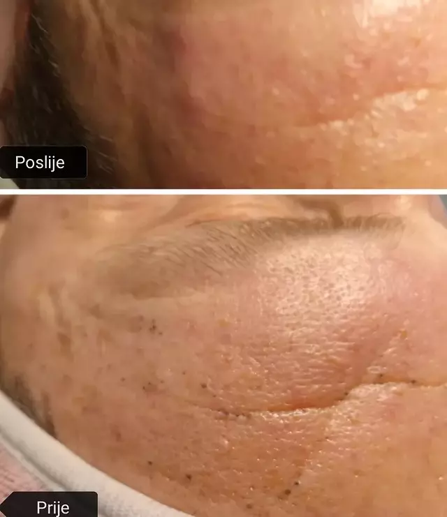 Relax masaže u Derventi