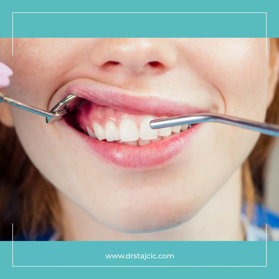 Implantologija i oralna hirurgija i stomatologija Oralna hirurgija i implantologija i stomatologija BiH