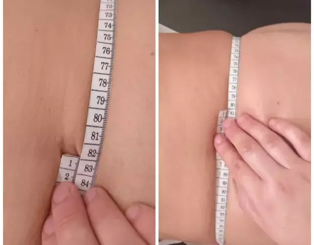 Tretmani lica u Derventi