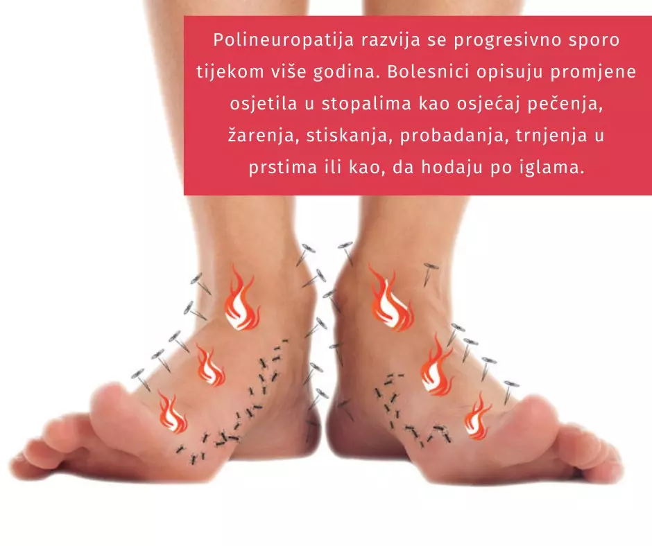 Kronične rane Tugare Hrvatska