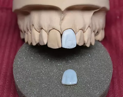 Zubotehničkilaboratorijimostovitekruniceiproteze,Split,Splitsko-dalmatinskažupanija2