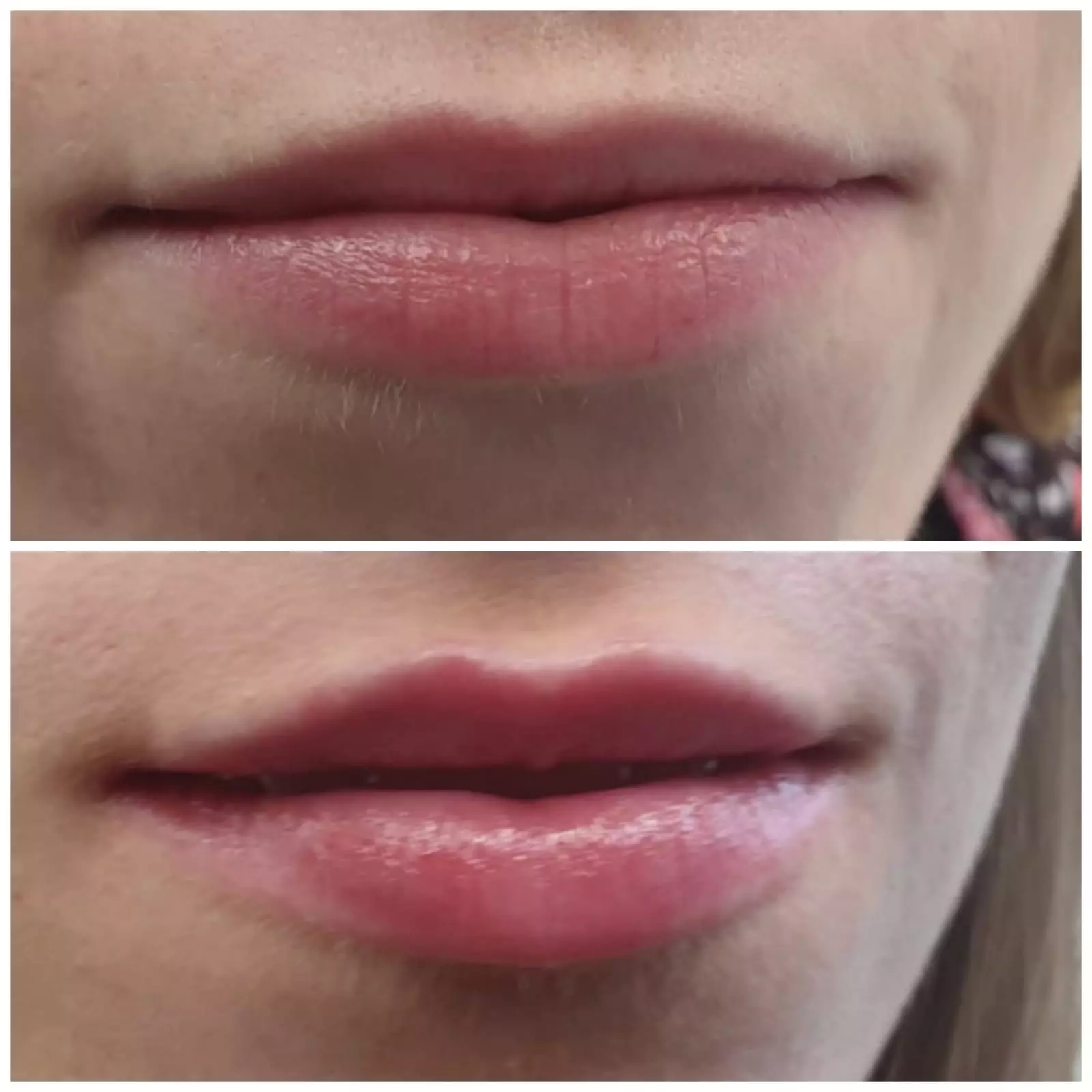 dentalmimica-estetikalica5