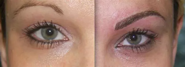 Anti-aging tretmani Vukovar, RH