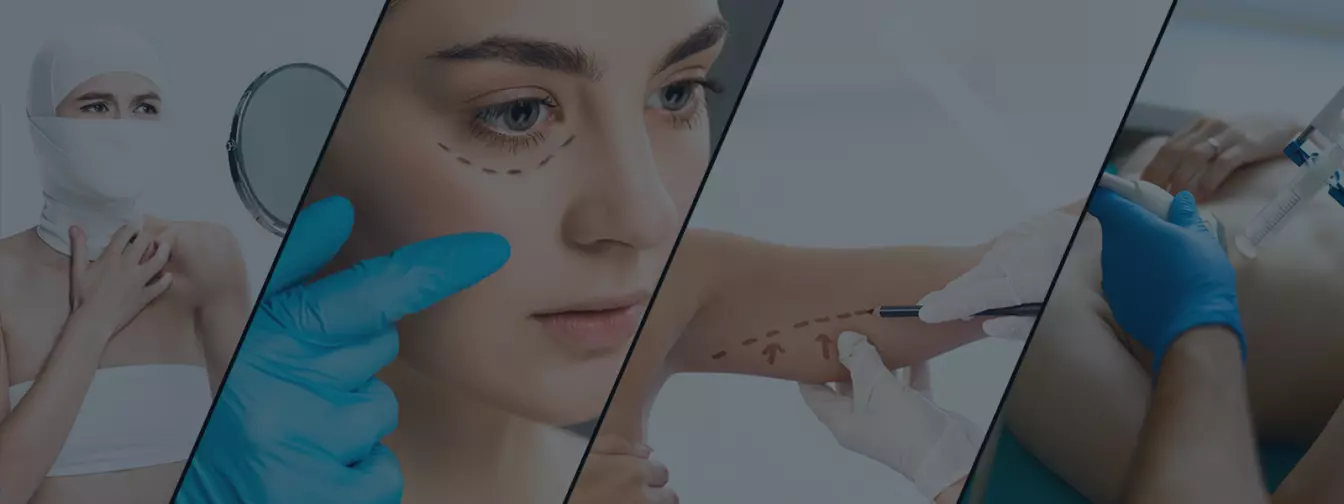 Plastična i rekonstruktivna kirurgija