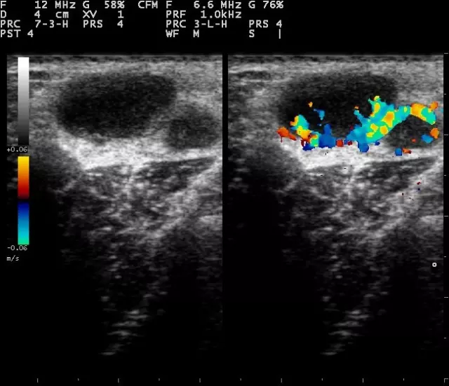 Ultrazvučna dijagnostika i color doppler, Pazin, Istra2.jpg